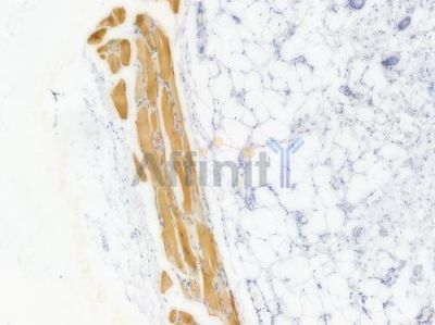 ACTN3 Recombinant Rabbit mAb - BF3995 at 1/100 staining Rat liver tissue by IHC-P.