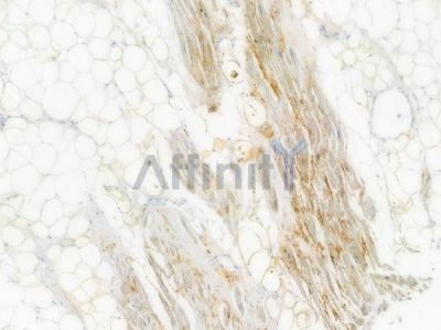 ACTN3 Recombinant Rabbit mAb - BF3995 at 1/100 staining Human heart tissue by IHC-P.