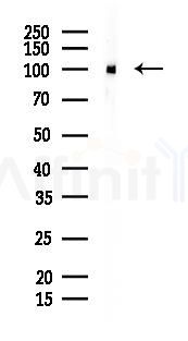 ACTN3 Recombinant Rabbit mAb - Western blot analysis of lysates from Rat lung, using ACTN3 Recombinant Rabbit mAb at 1/1000 dilution.
