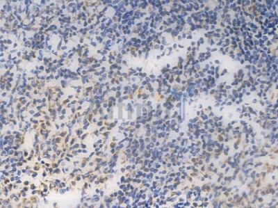 PHB2 Recombinant Rabbit mAb - BF3996 at 1/100 staining Human tonsil tissue by IHC-P.