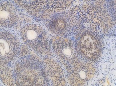 PHB2 Recombinant Rabbit mAb - BF3996 at 1/100 staining Rat spleen tissue by IHC-P.