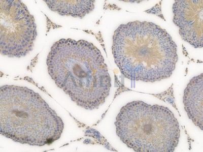 GNB2L1 Recombinant Rabbit mAb - BF3997 at 1/100 staining Rat lung tissue by IHC-P.