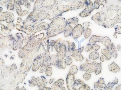 MEK1/2 Recombinant Rabbit mAb - BF3998 at 1/100 staining Human placental tissue by IHC-P.