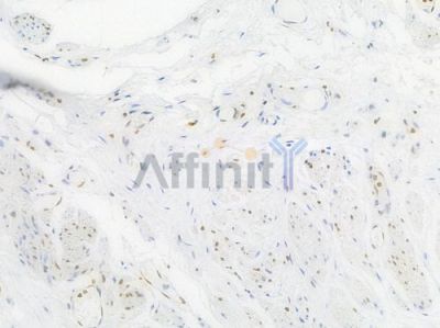 Histone H1.3 Recombinant Rabbit mAb - BF3999 at 1/100 staining Human esophageal tissue by IHC-P.