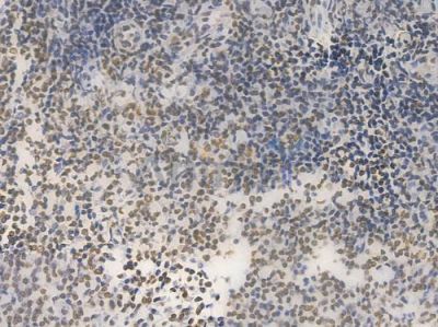 Histone H1.3 Recombinant Rabbit mAb - BF3999 at 1/100 staining Human tonsil tissue by IHC-P.
