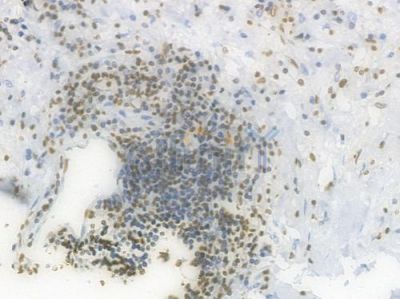 Histone H1.3 Recombinant Rabbit mAb - BF3999 at 1/100 staining Human gastric tissue by IHC-P.