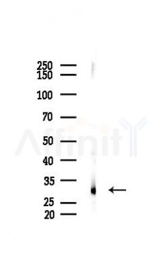 Histone H1.3 Recombinant Rabbit mAb - Western blot analysis of lysates from COLO205 cells(UV 30min treatment), using Histone H1.