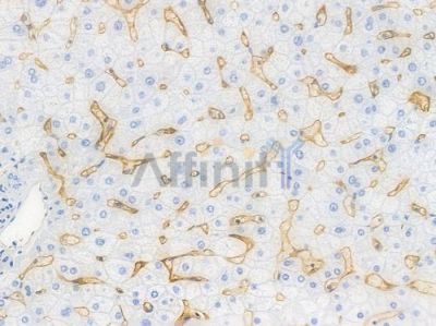 CD36 Recombinant Rabbit mAb - BF4000 at 1/100 staining Human liver tissue by IHC-P.