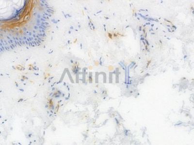 CD36 Recombinant Rabbit mAb - BF4000 at 1/100 staining Human skin tissue by IHC-P.