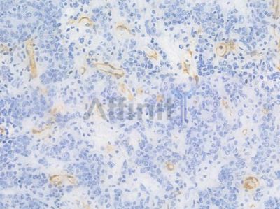 CD36 Recombinant Rabbit mAb - BF4000 at 1/100 staining Human gastric tissue by IHC-P.