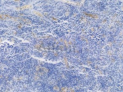 CD36 Recombinant Rabbit mAb - BF4000 at 1/100 staining Human tonsil tissue by IHC-P.