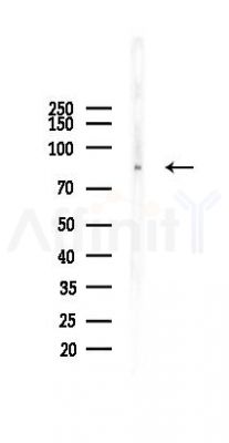 CD36 Recombinant Rabbit mAb - Western blot analysis of lysates from Mouse testis, using CD36 Recombinant Rabbit mAb at 1/1000 dilution.