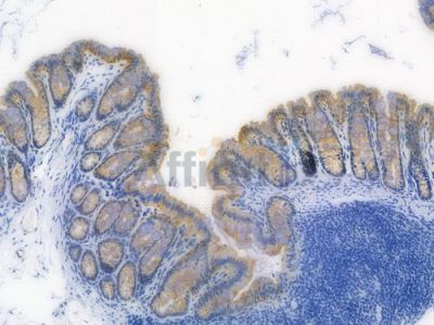 MGST3 Recombinant Rabbit mAb - BF4001 at 1/100 staining Mouse rectal tissue by IHC-P.