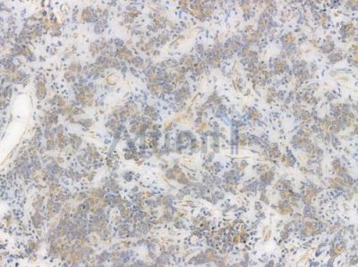 MGST3 Recombinant Rabbit mAb - BF4001 at 1/100 staining Human gastric tissue by IHC-P.