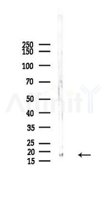MGST3 Recombinant Rabbit mAb - Western blot analysis of lysates from HepG2 cells(heat-shock 45min treatment), using MGST3 Recombinant Rabbit mAb at 1/1000 dilution.