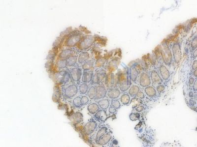 GSDMD Recombinant Rabbit mAb - BF4002 at 1/100 staining Mouse rectal tissue by IHC-P.