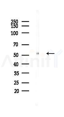GSDMD Recombinant Rabbit mAb - Western blot analysis of lysates from Mouse kidney, using GSDMD Recombinant Rabbit mAb at 1/1000 dilution.