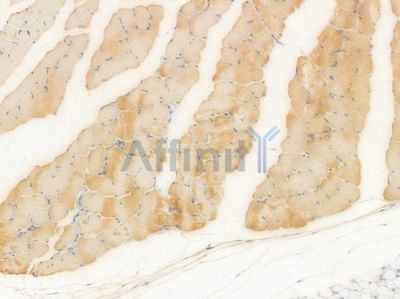 RRM2 Recombinant Rabbit mAb - BF4003 at 1/100 staining Mouse skeletal muscle tissue by IHC-P.
