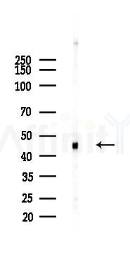 RRM2 Recombinant Rabbit mAb - Western blot analysis of lysates from Hela cells(LPS 4h treatment), using RRM2 Recombinant Rabbit mAb at 1/1000 dilution.