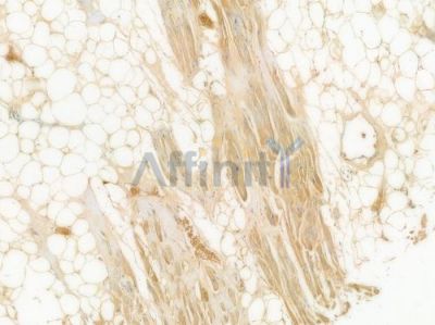 Nidogen Recombinant Rabbit mAb - BF4004 at 1/100 staining Human heart tissue by IHC-P.