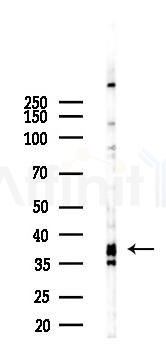 UCHL5 Recombinant Rabbit mAb - Western blot analysis of lysates from Hela cells(LPS 4h treatment), using UCHL5 Recombinant Rabbit mAb at 1/1000 dilution.
