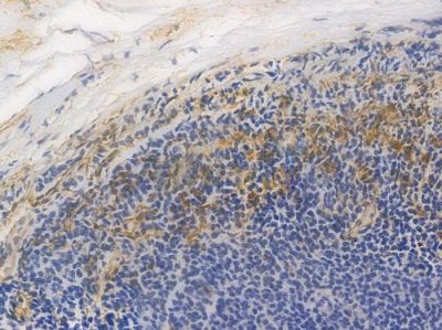 MYH10 Recombinant Rabbit mAb - BF4007 at 1/100 staining Human tonsil tissue by IHC-P.
