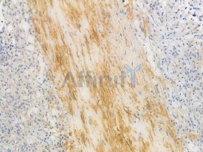 MYH10 Recombinant Rabbit mAb - BF4007 at 1/100 staining Human spleen tissue by IHC-P.