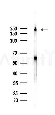 MYH10 Recombinant Rabbit mAb - Western blot analysis of lysates from A2780 cells(LPS 4h treatment), using MYH10 Recombinant Rabbit mAb at 1/1000 dilution.