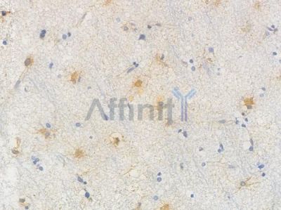 Bcr Recombinant Rabbit mAb - BF4008 at 1/100 staining Human brain tissue by IHC-P.