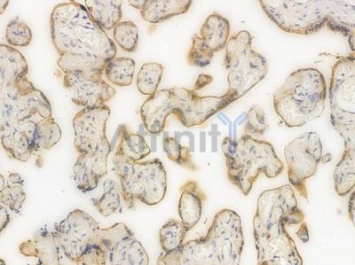 Bcr Recombinant Rabbit mAb - BF4008 at 1/100 staining Human placental tissue by IHC-P.