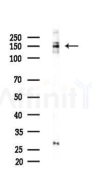 Bcr Recombinant Rabbit mAb - Western blot analysis of lysates from PC12 cells(UV 30min treatment), using Bcr Recombinant Rabbit mAb at 1/1000 dilution.