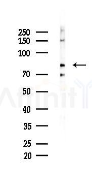 RANGAP1 Recombinant Rabbit mAb - Western blot analysis of lysates from Rat testis, using RANGAP1 Recombinant Rabbit mAb at 1/1000 dilution.