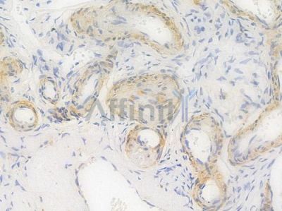 IHH Recombinant Rabbit mAb - BF4010 at 1/100 staining Human lymph node tissue by IHC-P.