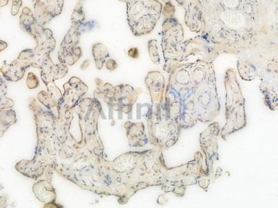 VPS35 Recombinant Rabbit mAb - BF4011 at 1/100 staining Human placental tissue by IHC-P.