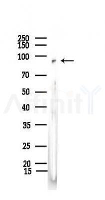VPS35 Recombinant Rabbit mAb - Western blot analysis of lysates from Mouse brain, using VPS35 Recombinant Rabbit mAb at 1/1000 dilution.