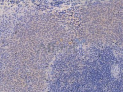 Phospho-PKC alpha (Ser657) Recombinant Rabbit mAb - BF4012 at 1/100 staining Rat spleen tissue by IHC-P.