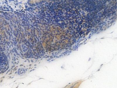 Phospho-PKC alpha (Ser657) Recombinant Rabbit mAb - BF4012 at 1/100 staining Mouse rectal tissue by IHC-P.