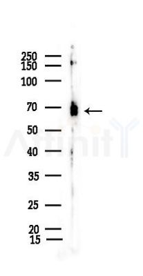 Phospho-PKC alpha (Ser657) Recombinant Rabbit mAb - Western blot analysis of lysates from PC12 cells(UV 30min treatment), using Phospho-PKC alpha (Ser657) Recombinant Rabbit mAb at 1/1000 dilution.