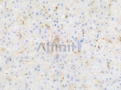 MSN Recombinant Rabbit mAb - BF4015 at 1/100 staining Human liver tissue by IHC-P.