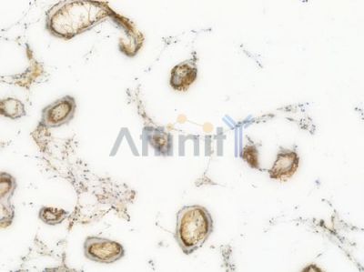 EEF2 Recombinant Rabbit mAb - BF4017 at 1/100 staining Human testicular tissue by IHC-P.