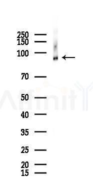 EEF2 Recombinant Rabbit mAb - Western blot analysis of lysates from Mouse kidney, using EEF2 Recombinant Rabbit mAb at 1/1000 dilution.