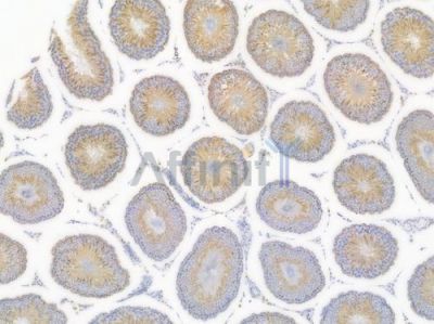 Sortilin Recombinant Rabbit mAb - BF4018 at 1/100 staining Rat lung tissue by IHC-P.