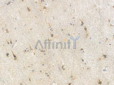 Sortilin Recombinant Rabbit mAb - BF4018 at 1/100 staining Human brain tissue by IHC-P.