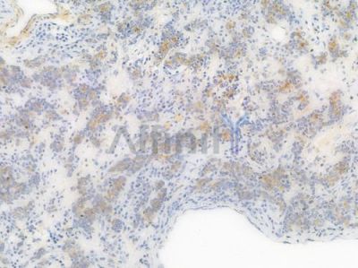 Sortilin Recombinant Rabbit mAb - BF4018 at 1/100 staining Human gastric tissue by IHC-P.