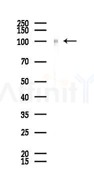 Sortilin Recombinant Rabbit mAb - Western blot analysis of lysates from Mouse brain, using Sortilin Recombinant Rabbit mAb at 1/1000 dilution.