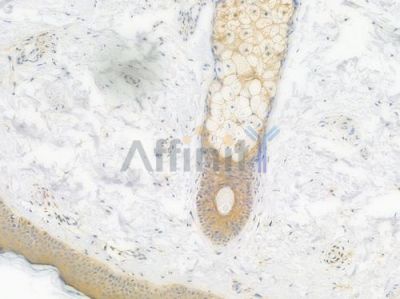 ATP6V1A Recombinant Rabbit mAb - BF4021 at 1/100 staining Human skin tissue by IHC-P.