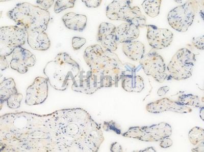 ATP6V1A Recombinant Rabbit mAb - BF4021 at 1/100 staining Human placental tissue by IHC-P.