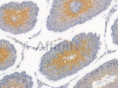 CtBP1 Recombinant Rabbit mAb - BF4022 at 1/100 staining Rat testicular tissue by IHC-P.