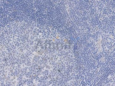 CtBP1 Recombinant Rabbit mAb - BF4022 at 1/100 staining Human tonsil tissue by IHC-P.