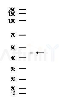 CtBP1 Recombinant Rabbit mAb - Western blot analysis of lysates from PC12 cells(UV 30min treatment), using CtBP1 Recombinant Rabbit mAb at 1/1000 dilution.